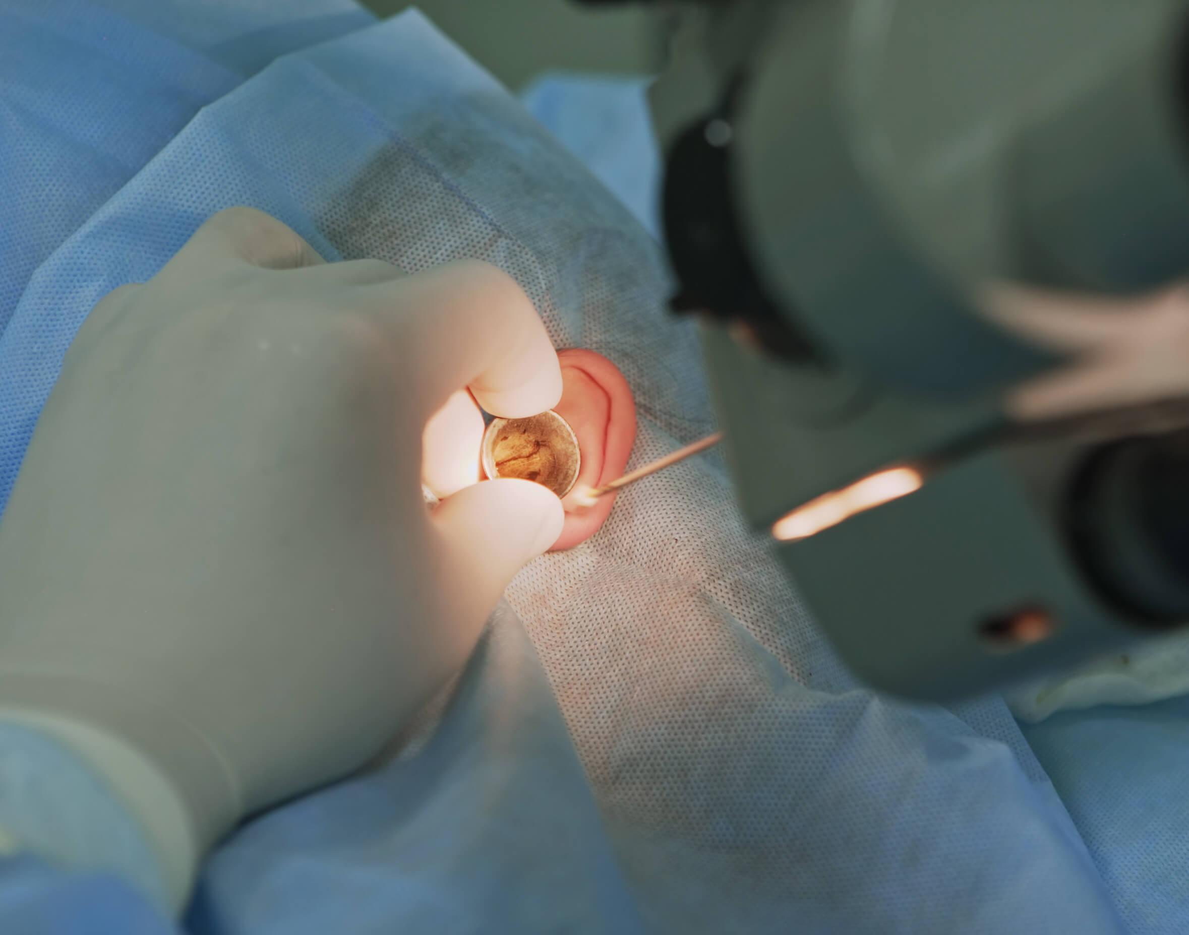 Micro Ear Surgery in nashik