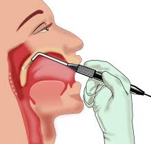 Snoring surgery in nashik