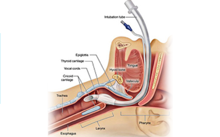 Vocal-Cord-Surgery