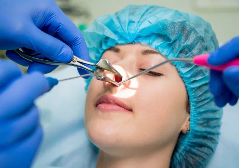 sinus surgery in nashik